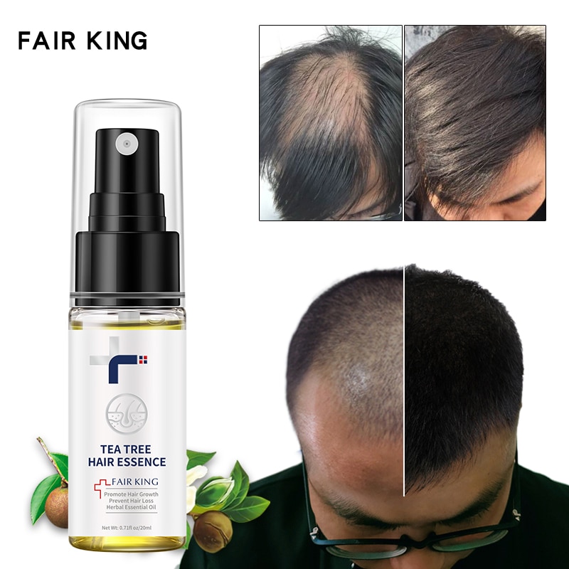 Hair Growth Spray Fast Growing Hair Essential Oils Beauty Hair Care Products Prevent Hair Loss Oil Scalp Treatment For Men Women